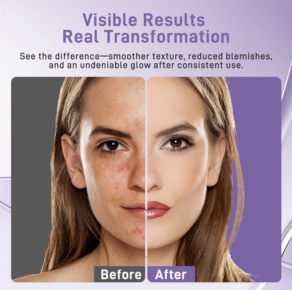 NEUVIÈRE LED Photon Therapy Face Mask